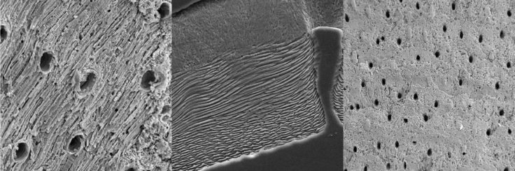 The brachiopod, Liothyrella uva, as seen using scanning electron microscopy